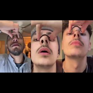 Nasal Dilator Sleep Nasal Stop Snoring Breathing Dilators Starter Kit Nose Breathe Strips Nasal Strips Increase Air