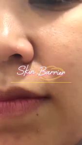 Scarlett Whitening Ceramide Moisture Boost Oil: Kulit Sehat & Terlindungi