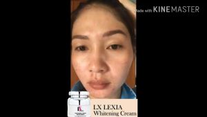 LX LEXIA WHITENING CREAM ครีมบำรุง ผิวหน้า สูตรเข้มข้น สิว ฝ้ากระ จุดด่างดำ ริ้วรอย ขนาด 30g. / Anna