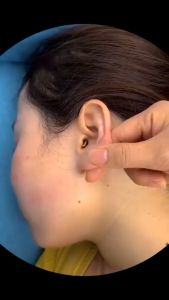 KOREK KUPING 5 IN 1 / PAKET ALAT PEMBERSIH KUPING STAINLESS STEEL