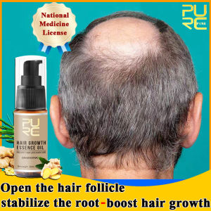 【Ship from Manila】PURC hair growth spray original for men ginger hair growth essence oil purc hair growth serum original anti hair loss treatment hair growth professional Stimulates Hair Growth Rapidly Prevents Hair Loss Solution for Women(30ml)