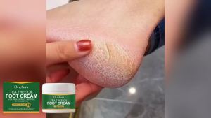 Tea Tree Oil Foot Cream Relieve Rough Anti-Peeling Eliminate Foot Odor Removal Dead Skin Dry Crack Repair Refreshing Foot Care