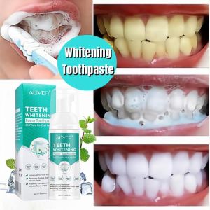 IVY ALIVER Teeth Whitening Toothpaste Mousse Toothpaste Cleansing teeth Mousse Remove Plaque Tooth Cleaning Whitening Tooth Mousse Fresh Breath Toothpaste Bright Teet 60ml