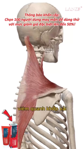 Kem Xoa Bóp Giảm Đau Xương Khớp LANZF Pain Relief – Kem Chondroitin Sodium LANZF Phục Hồi Cơ Xương Khớp Cổ Vai Gáy