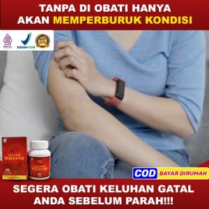 Jiancare Zhiyang Original: Obat Herbal Atasi Gatal Alergi, Kudis & Kurap