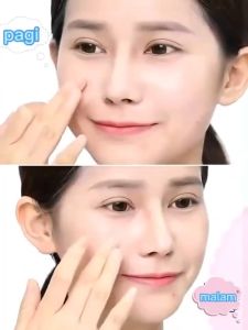 Salicylic Acid Acne Cream Shrink Pore Improve Blackheads Oil Control Cream Acne Scar Whitening Face Cream Skincare 20g
