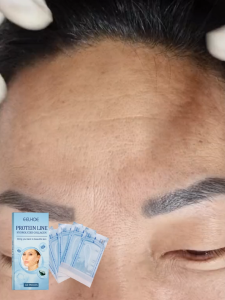 EELHOE Protein Lifting Thread Anti-Wrinkle V-Line Lift Tightening Facial Contour 60pcs Enhances Firmness