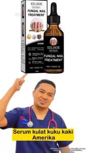 KeraSys เซรั่มบำรุงเล็บ เชื้อราเล็บมือ แก้เชื้อราที่เล็บ บำรุงเล็บ ลากับเล็บเสีย ไม่ทำร้ายเล็บดี ห่างกับปัญหาเล็บ ซ่อมแซมเล็บ บอกลาเล็บเสีย! น้ำยารักษาเชื้อราที่เล็บ น้ำยาซ่อมแซมเล็บเหลือง น้ำยารักษาเล็บ กำจัดเล็บเสีย ซ่อมแซมเล็บแตก
