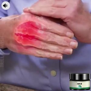 Gout Treatment Cream Gout Pain Relief Cream Arthritis Rheumatism Pain Relieve Ointment 35g Ointment Self Heating Relieve Rheumatoid Arthritis Back Pain And  Correct Muscle Joints Valguspain Fingers Toes Swelling  Relief  Treatment Medical Plaster