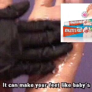 Foot Antibacterial Cream Foot Deodorant Cream Beriberi Ointment 20g Fungus Psoriasis Athlete Foot Peeling Remove Tinea Pedis