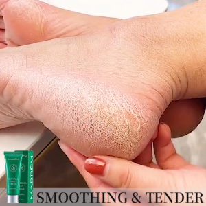 MABREM Calendula Foot Cream Heel Crack Repair Cream Specially Treats Cracked Heels Dry Hard Skin and Peeling on the Soles of Feet 40g
