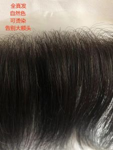 Natural Hairline Hair Loss Patch Nano Biological Membrane Pure Real Human Hair Invisible Realistic for Men And Women Dyeable