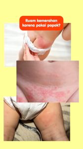 Zwitsal Baby Diaper Cream 50gr - Zwitsal Baby Cream
