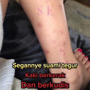 [HOT SELLING] SABUN PUTEHH SEPUK ORI HQ Putehh Sepuk Soap Whitening Scrub Sabun DakI hilang sunburn