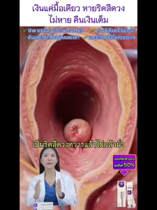 ประสบการณ์ใหม่ของการดูแลริดสีดวงทวาร ที่อ่อนโยนและได้ผลลัพธ์ดี ด้วย Kreain Nature เจลสมุนไพร