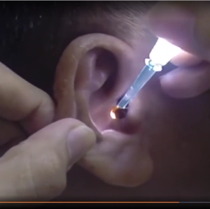 BUY 1 TAKE 1 - LED Flashlight Ear Pick Wax Remover – Reusable Ear Cleaner Tool for Safe & Easy Earwax Removal