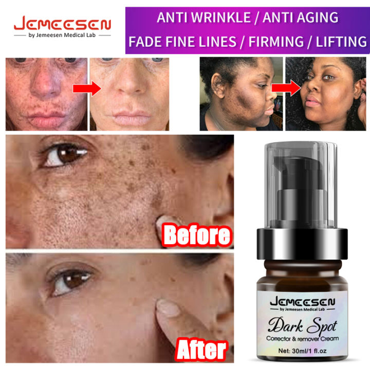 Jemeesen Whitening Freckle Cream Dark Spot Remover Spot Corrector