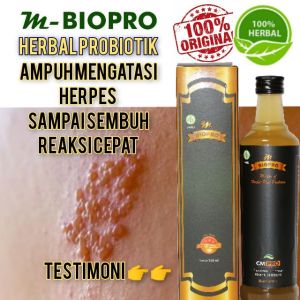 Obat Herpes Paling Ampuh l Obat Herpes Kulit l Obat Herpes Kelamin
