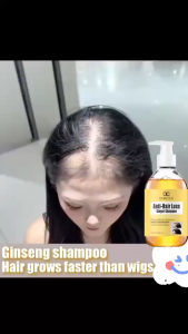✨การเจริญเติบโตและการบำรุงเส้นผม✨แชมพูขิงเพียว 300ml แชมพูแก้ผมร่วง แชมพูปลูกผมดก สมุนไพร บำรุงรากผม หยุดผมร่วง เร่งผมงอกใหม่