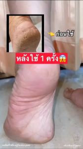 สปาเท้า ธัญนิสา 1 แถม 1 ส้นเท้าแตก เท้าดำ ส้นแตก กลิ่นเท้าเหม็น ชุดสปาเท้าธัญนิสา เซ็ตขัด + ครีมบำรุงเท้า เท้าแตก ขัดเท้า สปาส้นเท้า