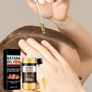 Batana Oil Spray Repairs Baldness Strengthens Hair Natural Nourishment Hereditary Loss TreatmentMoisturizes Scalp All Genders