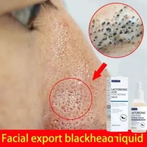EELHOE Hyaluronic Acid Snails Face Serum Anti-wrinkle Moisturize Shrink Pore Brighten Skin Care-Serum Wajah - Pemutih Kulit Wajah - Pengglowing Wajah - Wajah Glowing 30ML
