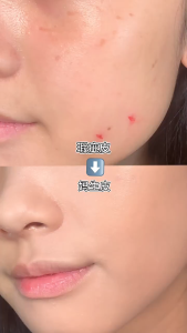 XIXI 3-Color Full Coverage Concealer - Waterproof Corrector for Blemishes Dark Circles & Fine Lines