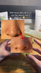 Mặt nạ đất sét Beplain Mung Bean Pore Clay Mask 120ml từ đậu xanh giúp hút dầu giảm mụn đầu đen