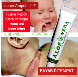 Salep Aloevera Antifungal Menyembuhkan Iritasi Kulit Bayi Ruam Popok - Ruam Keringat