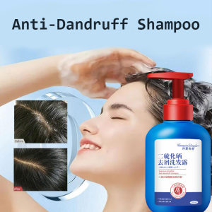 Selenium sulfide Anti-Kelemuur Shampoo Scalp Psoriasis Selenium Rich Controls Dandruff Soothes Irritation Oil Control Anti-Dandruff Scalp Treatment 300ml