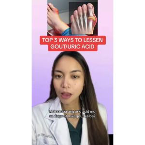 Gout Patches Arching Bunion Relief | Gout Pain Plaster for Finger Toe & Other Parts | Hypoallergenic | 1 Pack - 8pcs