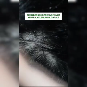 [PROMOTION] Verble Dandruff Shampoo Hair Loss  Oily Scalp Hair Growth Syampu Anti Kelemumur Rambut Gugur Ginseng Extract - Official HQ