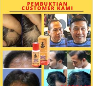 SHAMPOO SAMPO PEMANJANG RAMBUT SHAMPO RAMBUT BOTAK PERAWATAN RAMBUT SHAMPO PRIA SHAMPO COWO BOTAK