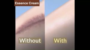Scar Removal Cream Scar Repair Cream Acne Scar Remover For Old And New Scar Face and Body Skin Repair Strech Mark Removal