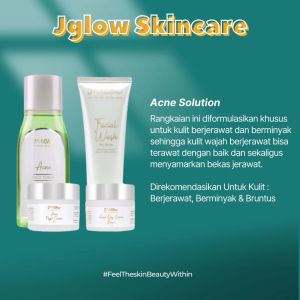 JGLOW ACNE SOLUTION untuk kulit berminyak berkomedo dan berjerawat ringan