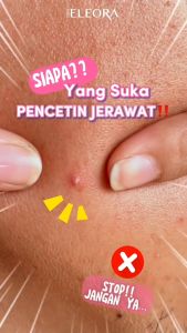 ACNE PRONE SKINCARE -  DWHISP GLOW