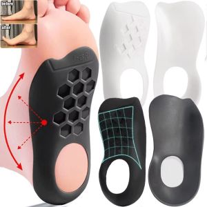 พื้นในรองเท้าตามหลักกายวิภาคสำหรับ Plantar Fasciitis การบำบัดเพื่อคลายความปวดเท้าแบนแผ่นรองเท้าพื้นรองเท้าสำหรับรองเท้าผู้หญิงผู้ชายแก้ไข XO-Legs