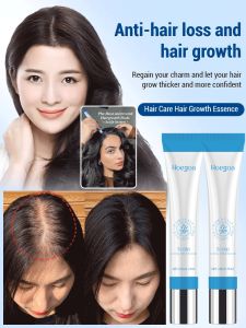 Hair essence roller Nourishing scalp essence💖 Anti-hair loss essence Dandruff removal and itching r