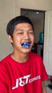 1 คู่ รางฟอกฟัน Dental Switz ฟอกฟันขาว ฟอกฟันที่ดีที่สุด