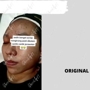 CB Oval Whitening Cream: CREAM PENCERAH WAJAH CB CREAM KOREA ORIGINAL / PENCERAH WAJAH