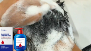 Hoegoa selenium disulfide sampo mencegah minyak rambut membersihkan kulit kepalamembersihkan rambut lembut menyegarkan rambut bulus