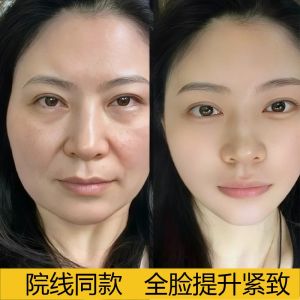 Collagen Facial Mask Skin Tightening Beauty Salon Wrinkle Fading Jawline Enhancer V-Face Device Anti-Aging Hydrating Gel