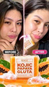 MCC RENUE KOJIC PAPAYA GLUTA 135g - MCC PRIME LIFESTYLE PALIPARAN DASMA CAVITE