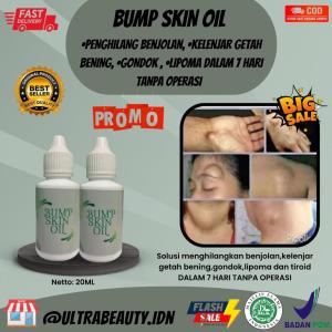 <TERLARIS> PENGHILANG BENJOLAN 5 HARI CEPATAMPUH DAN PERMANEN {BUMPSKIN OIL} Obat penghilang benjolan terbaik \ Minyak oles benjolan alami \ Kelenjar getah bening \ Gondok \ Lipoma \ BPOMHALAL [COD/BAYAR DITEMPAT]