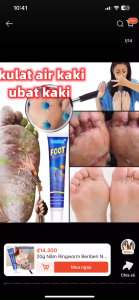 [COMBO KHUYẾN MÃI] Kem Bôi Da Liễu Loại Bỏ Nấm Ngứa Ở Chân Giảm Mùi Hôi Khó Chịu Ở Chân Giúp Da Mềm Mịn Chắc Khỏe