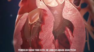 Obat Hipertensi Darah Tinggi Vertigo Sakit Kepala Migran Apirex Bharata 100% Original Resmi BPOM