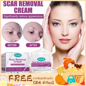 OUHOE ครีมปกปิดรอยแผลเป็นสำหรับใบหน้าและร่างกาย รอยแผลเป็นจากสิว ครีมปกปิดรอยแตกลาย การฟื้นฟูผิว ครีมปกปิดสิว --- 50 กรัม