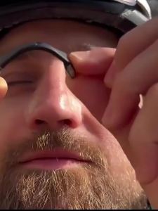 แผ่นขยายโพรงจมูกแม่เหล็ก ชุดเริ่มต้นขยายโพรงจมูก ลดการกรนจากจมูก แผ่นขยายโพรงจมูกแม่เหล็ก