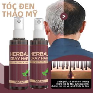 Polygonum Multiflorum Scalp Serum Essence Spray Để Phục Hồi Chân Tóc Xám/Trắng Thành Đen Điều Trị Dưỡng Tóc 100ml