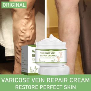 Original Herbs Varicose Vein Cream Spider Varicose Veins Vasculitis Phlebitis Promote Blood Circulation Relieve Swelling of Veins Varicose Veins Cream